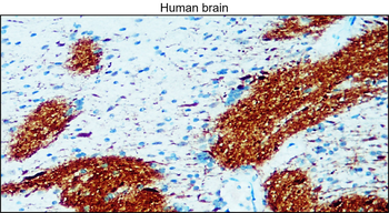 Enolase-2 Rabbit Polyclonal Antibody