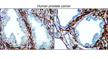 Enolase-2 Rabbit Polyclonal Antibody
