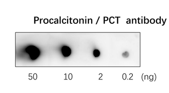 Procalcitonin Rabbit Polyclonal Antibody