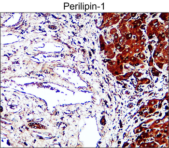 Perilipin-1 Rabbit Polyclonal Antibody