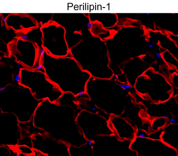 Perilipin-1 Rabbit Polyclonal Antibody