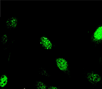 PCNA Rabbit Polyclonal Antibody