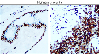 PCNA Rabbit Polyclonal Antibody
