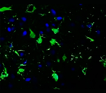 S100B Rabbit Polyclonal Antibody