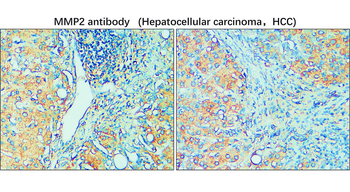 MMP2 c-term Rabbit Polyclonal Antibody