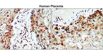 MMP2 c-term Rabbit Polyclonal Antibody
