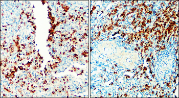 Toll-like Receptor 9 Rabbit Polyclonal Antibody