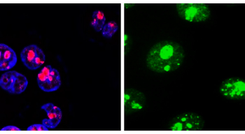 KI-67 Rabbit Polyclonal Antibody