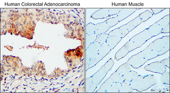MUC1 Rabbit Polyclonal Antibody