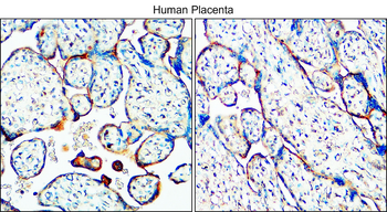 MUC1 Rabbit Polyclonal Antibody