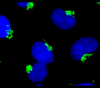 ASC Mouse Monoclonal Antibody