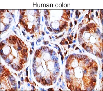 ASC Mouse Monoclonal Antibody