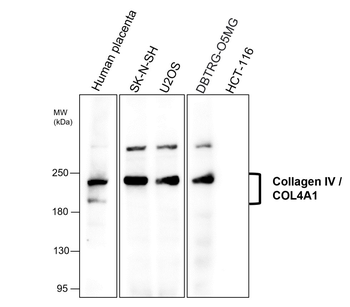 Collagen IV Rabbit Polyclonal Antibody