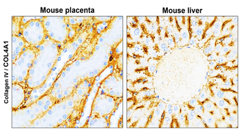 Collagen IV Rabbit Polyclonal Antibody