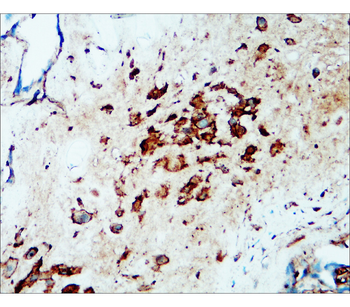 Flotillin-1 Rabbit Polyclonal Antibody