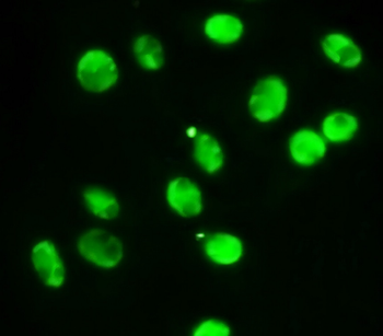 STAT1 Mouse Monoclonal Antibody