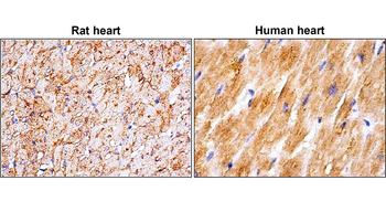GLUT4 Glucose Transporter Mouse Monoclonal Antibody