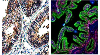 LAMP2 Mouse Monoclonal Antibody