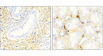 LAMP2 Mouse Monoclonal Antibody