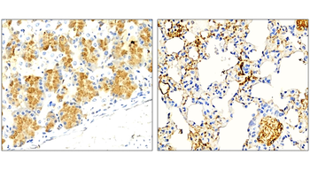 LAMP2 Mouse Monoclonal Antibody