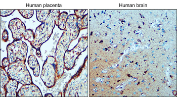 LAMP1 Rabbit Polyclonal Antibody