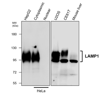 LAMP1 Rabbit Polyclonal Antibody