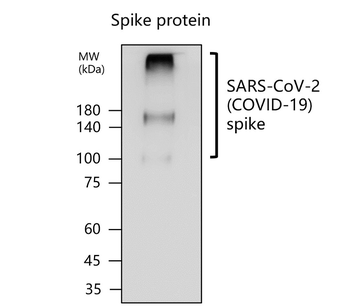 SARS-CoV-2 (COVID-19) Spike protein S2 Rabbit Polyclonal Antibody