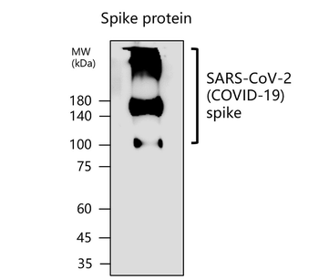 SARS-CoV-2 (COVID-19) Spike Protein S1-NTD Rabbit Polyclonal Antibody