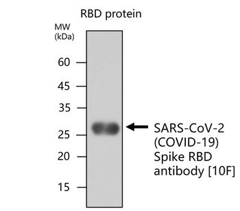 SARS-CoV-2 (COVID-19) Spike RBD Mouse Monoclonal Antibody