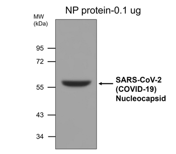SARS-CoV-2 nucleocapsid protein Mouse Monoclonal Antibody
