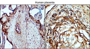 Collagen II Rabbit Polyclonal Antibody
