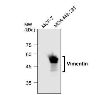 Epithelial-Mesenchymal Transition / EMT Marker Antibody Panel