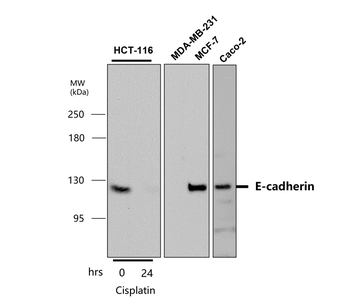 Epithelial-Mesenchymal Transition / EMT Marker Antibody Panel