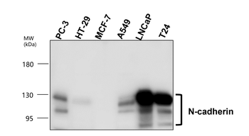 Epithelial-Mesenchymal Transition / EMT Marker Antibody Panel