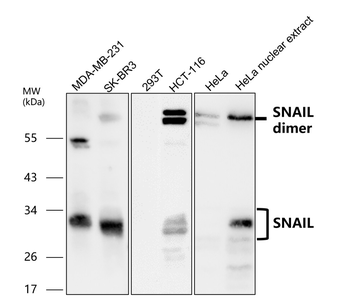 Epithelial-Mesenchymal Transition / EMT Marker Antibody Panel