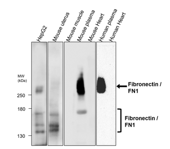 Epithelial-Mesenchymal Transition / EMT Marker Antibody Panel