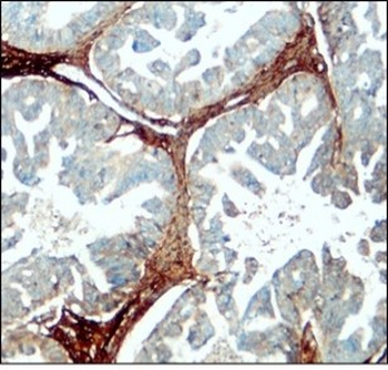 Myofibroblast / Fibrocyte Antibody Panel