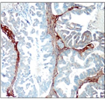 Myofibroblast / Fibrocyte Antibody Panel