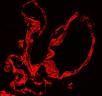 Myofibroblast / Fibrocyte Antibody Panel