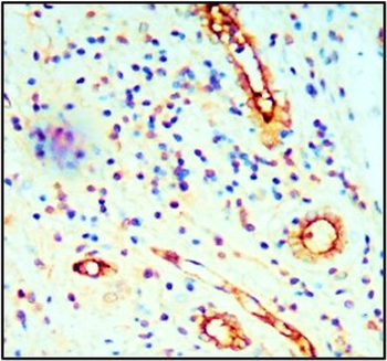 Myofibroblast / Fibrocyte Antibody Panel
