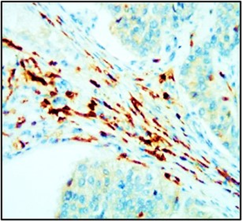 Myofibroblast / Fibrocyte Antibody Panel