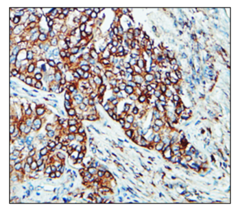 Cardiovascular Antibody Panel