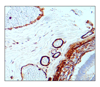 Cardiovascular Antibody Panel