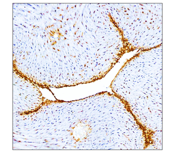 Cardiovascular Antibody Panel