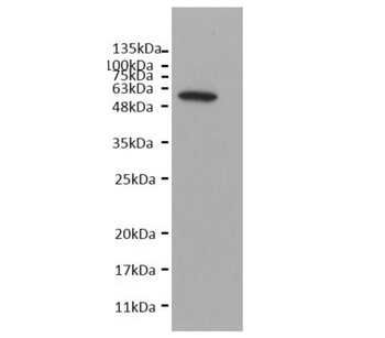 Loading Control Antibody Panel