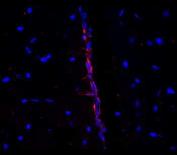 Neural Progenitors Marker Antibody Panel