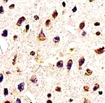 Neurodegeneration Antibody Panel