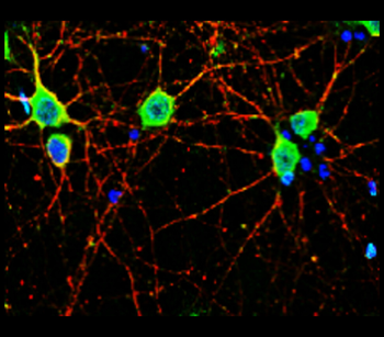 Neurodegeneration Antibody Panel