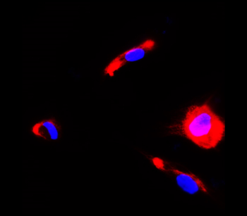 Neurodegeneration Antibody Panel