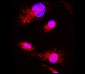 Neuroinflammation Antibody Panel